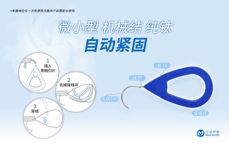 Easy-Knot®无菌钛夹 - 北京迈迪顶峰医疗科技股份有限公司